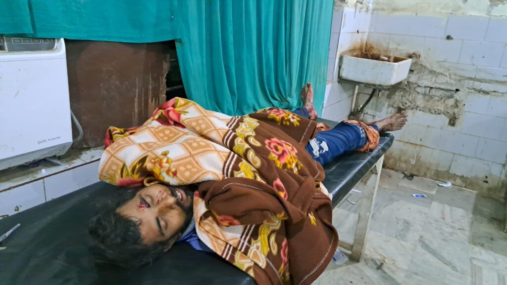 आमने सामने से टेम्पू की टक्कर में चार लोग घायल, एक की हालत गंभीर